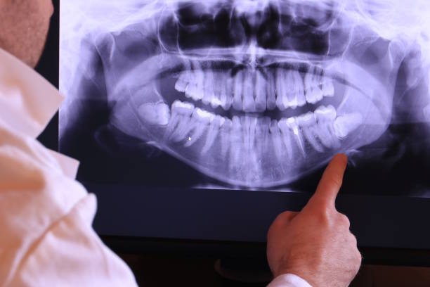 Best Emergency Dental Surgery in Winter Gardens, CA